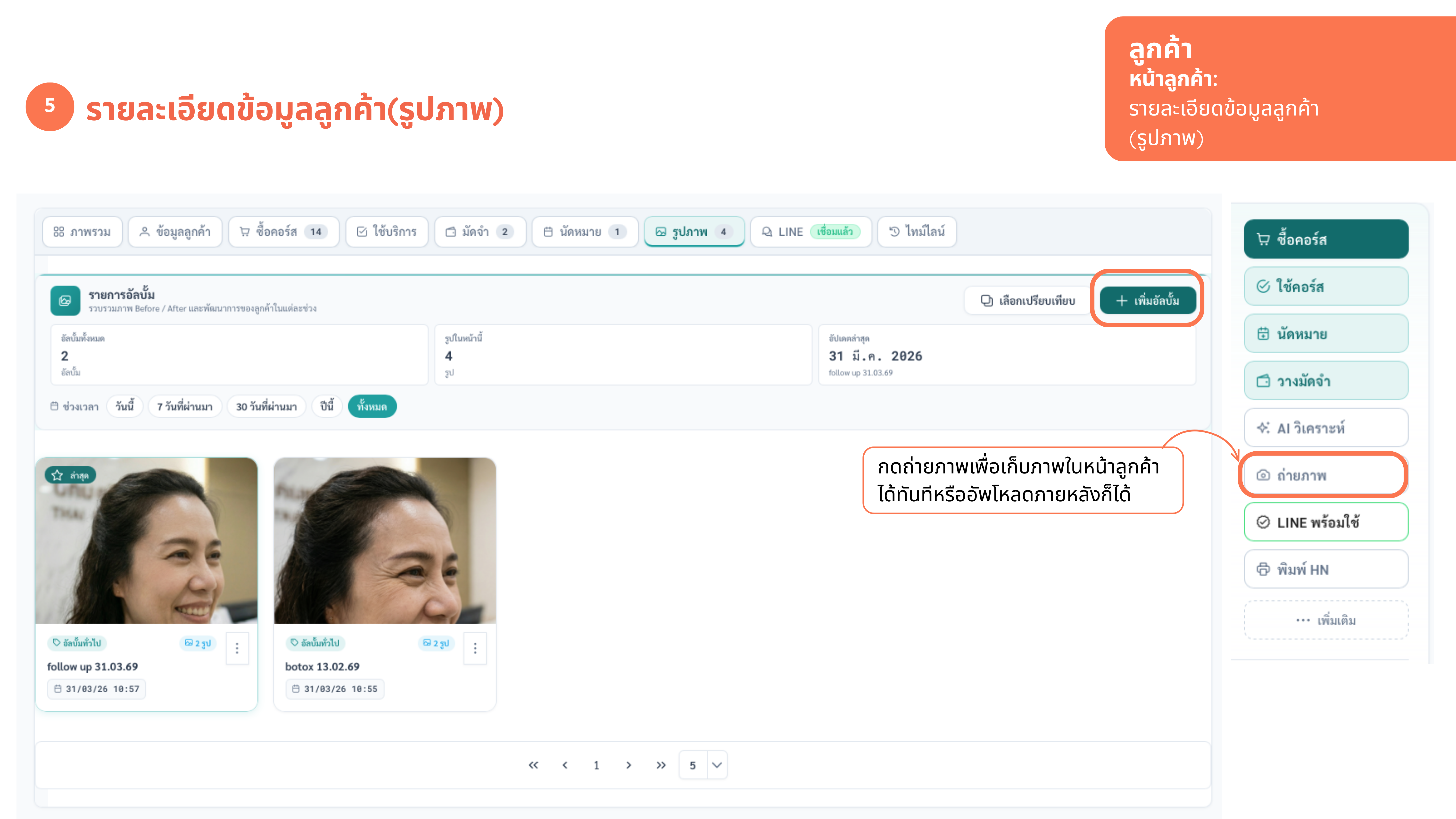 ภาพก่อน-หลัง — ภาพที่ 1