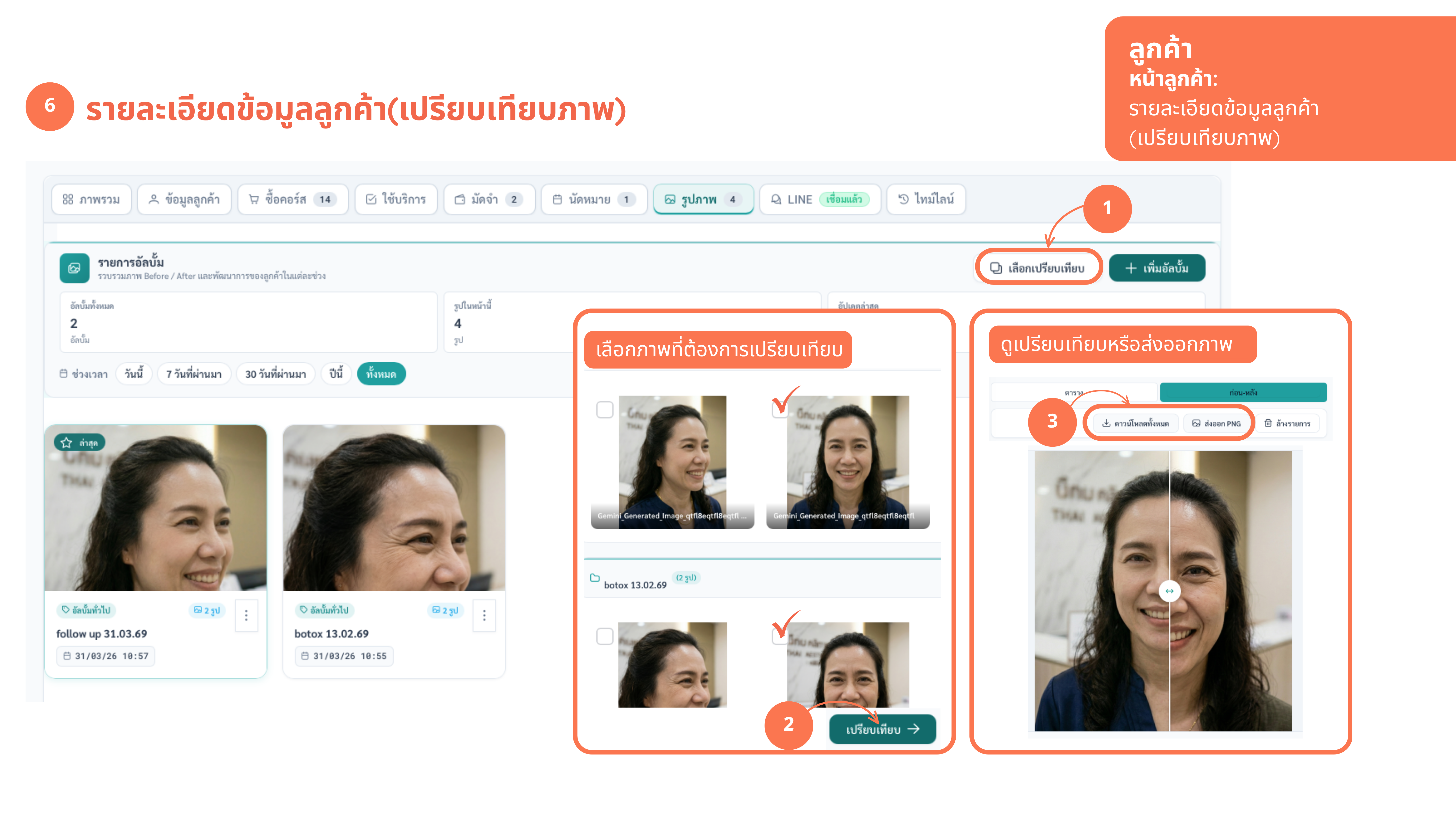 ภาพก่อน-หลัง — ภาพที่ 2